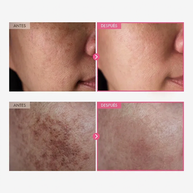 Crema aclarante coreana avanzada con arbutina Minova