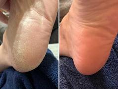Resultado de usuaria con Minova Soft